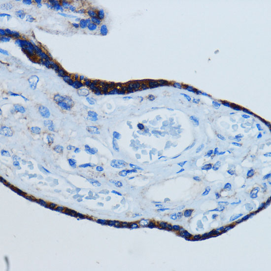 Immunohistochemistry of paraffin-embedded Human placenta using MMP2 Polyclonal Antibody at dilution of  1:100 (40x lens).