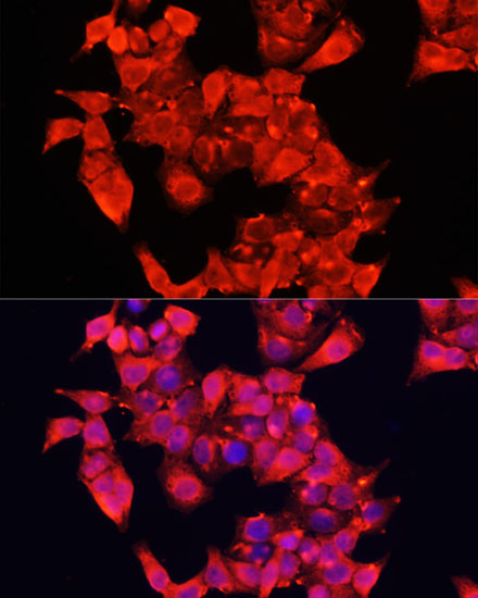 Immunofluorescence analysis of HeLa cells using AOC1 Polyclonal Antibody at dilution of  1:100 (40x lens). Blue: DAPI for nuclear staining.