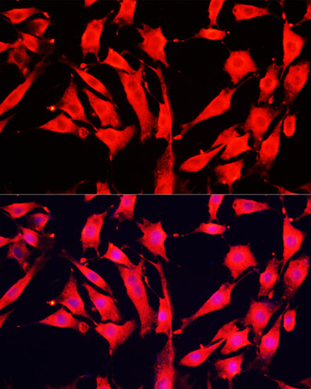 Immunofluorescence analysis of NIH-3T3 cells using AOC1 Polyclonal Antibody at dilution of  1:100 (40x lens). Blue: DAPI for nuclear staining.