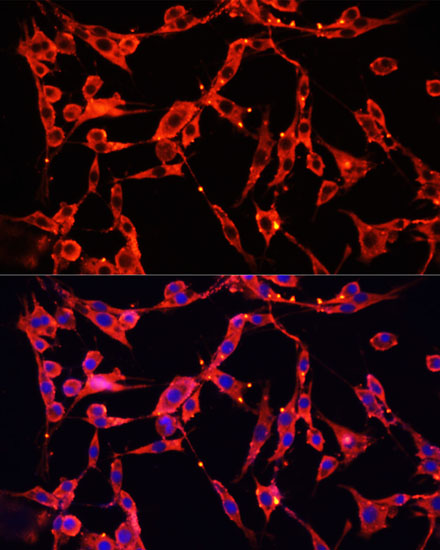 Immunofluorescence analysis of PC-12 cells using AOC1 Polyclonal Antibody at dilution of  1:100 (40x lens). Blue: DAPI for nuclear staining.