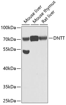 Western blot analysis of extracts of various cell lines using DNTT Polyclonal Antibody at dilution of 1:1000.