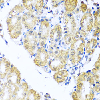 Immunohistochemistry of paraffin-embedded Human stomach using BNIP3L Polyclonal Antibody at dilution of  1:100 (40x lens).