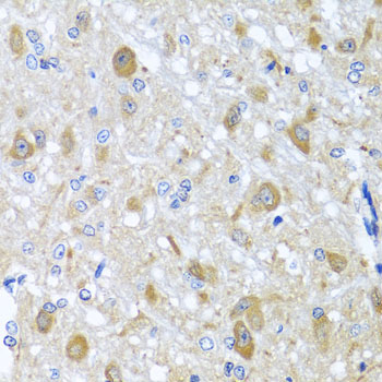 Immunohistochemistry of paraffin-embedded Rat brain using BNIP3L Polyclonal Antibody at dilution of  1:100 (40x lens).