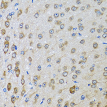 Immunohistochemistry of paraffin-embedded Rat brain using BTD Polyclonal Antibody at dilution of  1:100 (40x lens).