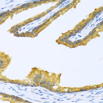 Immunohistochemistry of paraffin-embedded Human prostate using BTD Polyclonal Antibody at dilution of  1:100 (40x lens).