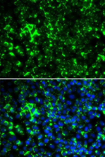 Immunofluorescence analysis of HeLa cells using KCNA2 Polyclonal Antibody