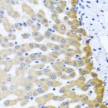 Immunohistochemistry of paraffin-embedded Human liver damage using M6PR Polyclonal Antibody at dilution of  1:100 (40x lens).