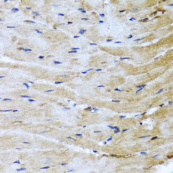 Immunohistochemistry of paraffin-embedded Mouse heart using M6PR Polyclonal Antibody at dilution of  1:100 (40x lens).