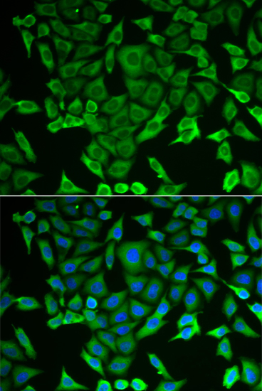 Immunofluorescence analysis of MCF-7 cells using RARS Polyclonal Antibody