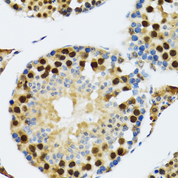 Immunohistochemistry of paraffin-embedded Rat testis using TXNL1 Polyclonal Antibody at dilution of  1:100 (40x lens).