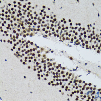 Immunohistochemistry of paraffin-embedded Rat brain using TXNL1 Polyclonal Antibody at dilution of  1:100 (40x lens).