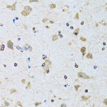 Immunohistochemistry of paraffin-embedded Rat brain using PDP1 Polyclonal Antibody at dilution of  1:100 (40x lens).