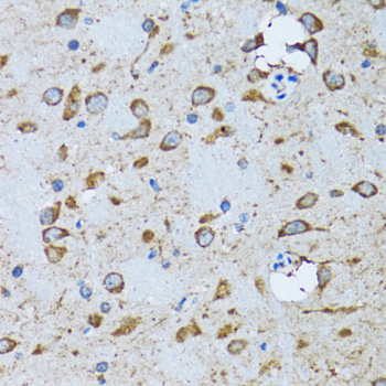 Immunohistochemistry of paraffin-embedded Mouse brain using PDP1 Polyclonal Antibody at dilution of  1:100 (40x lens).