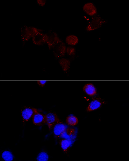 Immunofluorescence analysis of NIH/3T3 cells using BCAP29 Polyclonal Antibody at dilution of  1:100 (40x lens). Blue: DAPI for nuclear staining.