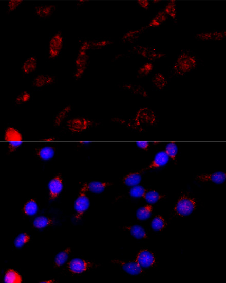 Immunofluorescence analysis of PC-12 cells using BCAP29 Polyclonal Antibody at dilution of  1:100 (40x lens). Blue: DAPI for nuclear staining.