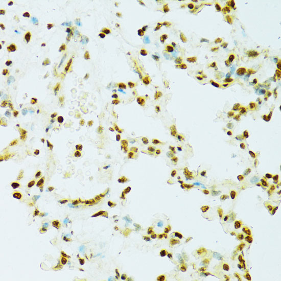 Immunohistochemistry of paraffin-embedded Rat lung using RCC1 Polyclonal Antibody at dilution of  1:100 (40x lens).