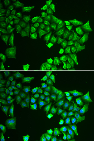 Immunofluorescence analysis of HeLa cells using ASL Polyclonal Antibody