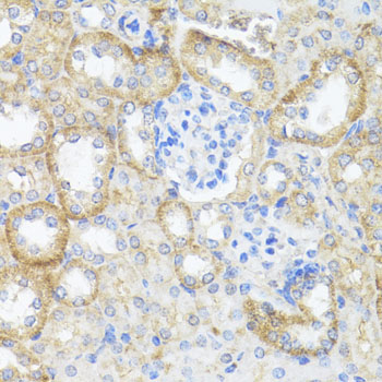 Immunohistochemistry of paraffin-embedded Mouse kidney using ASL Polyclonal Antibody at dilution of  1:100 (40x lens).