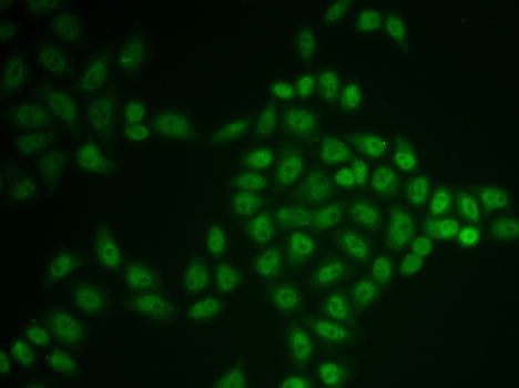 Immunofluorescence analysis of U2OS cells using BTG1 Polyclonal Antibody