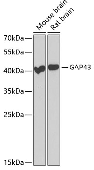 Western blot analysis of extracts of various cell lines using GAP43 Polyclonal Antibody at dilution of 1:1000.