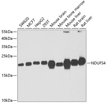 Western blot analysis of extracts of various cell lines using NDUFS4 Polyclonal Antibody at dilution of 1:1000.