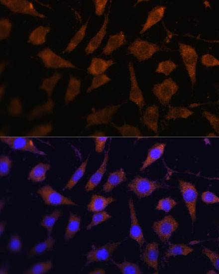 Immunofluorescence analysis of L929 cells using SERPINB9 Polyclonal Antibody at dilution of  1:100. Blue: DAPI for nuclear staining.