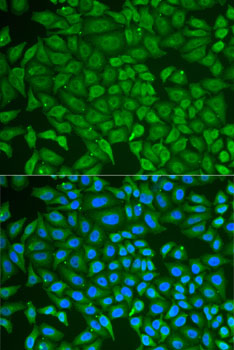 Immunofluorescence analysis of U2OS cells using PIP Polyclonal Antibody