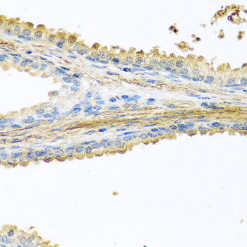 Immunohistochemistry of paraffin-embedded Human prostate using PIP Polyclonal Antibody at dilution of  1:100 (40x lens).