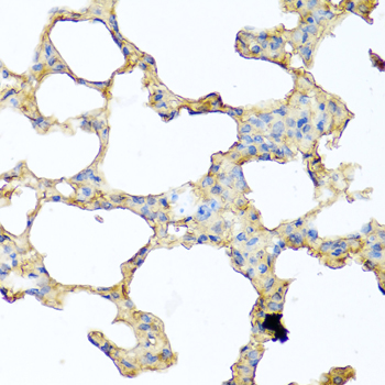 Immunohistochemistry of paraffin-embedded Mouse lung using PIP Polyclonal Antibody at dilution of  1:100 (40x lens).