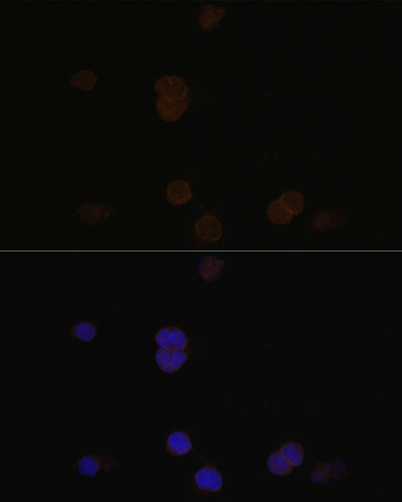 Immunofluorescence analysis of Y79 cells using RCVRN Polyclonal Antibody at dilution of  1:100. Blue: DAPI for nuclear staining.