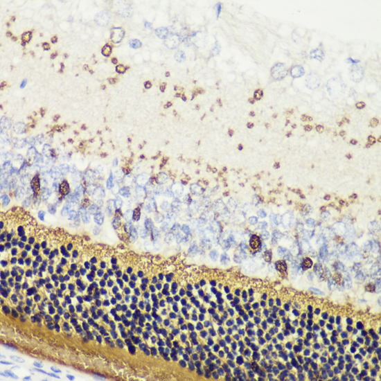 Immunohistochemistry of paraffin-embedded Rat retina using RCVRN Polyclonal Antibody at dilution of  1:200 (40x lens).