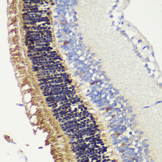 Immunohistochemistry of paraffin-embedded Mouse retina using RCVRN Polyclonal Antibody at dilution of  1:200 (40x lens).