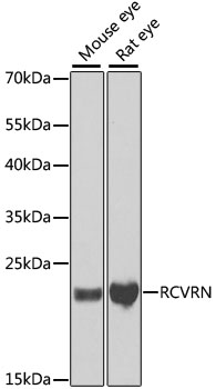 Western blot analysis of extracts of various cell lines using RCVRN Polyclonal Antibody at dilution of 1:1000.