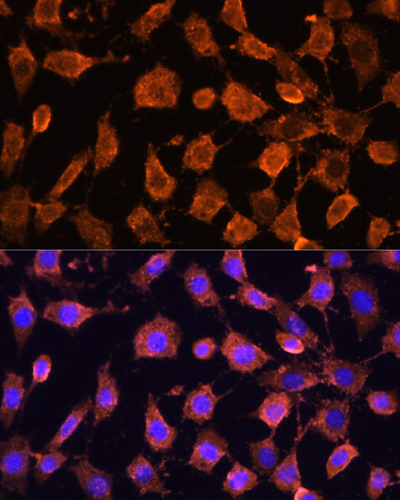 Immunofluorescence analysis of L929 cells using RPL11 Polyclonal Antibody at dilution of  1:100. Blue: DAPI for nuclear staining.