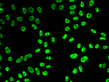 Immunofluorescence analysis of HeLa cells using SNRPA Polyclonal Antibody