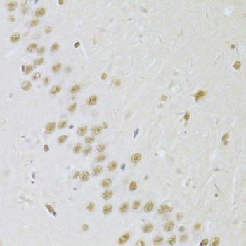 Immunohistochemistry of paraffin-embedded Rat brain using SNRPA Polyclonal Antibody at dilution of  1:100 (40x lens).