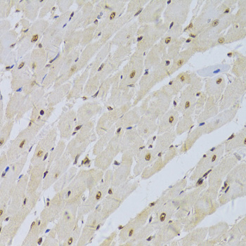 Immunohistochemistry of paraffin-embedded Rat heart using SNRPA Polyclonal Antibody at dilution of  1:100 (40x lens).