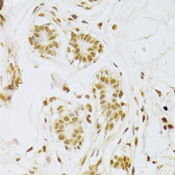 Immunohistochemistry of paraffin-embedded Human breast using SNRPA Polyclonal Antibody at dilution of  1:100 (40x lens).