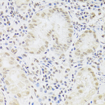 Immunohistochemistry of paraffin-embedded Human stomach using SNRPA Polyclonal Antibody at dilution of  1:100 (40x lens).