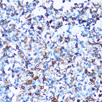 Immunohistochemistry of paraffin-embedded Human tonsil using SPN Polyclonal Antibody at dilution of  1:100 (40x lens).