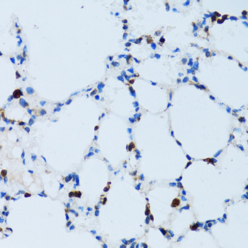 Immunohistochemistry of paraffin-embedded Mouse lung using SPN Polyclonal Antibody at dilution of  1:100 (40x lens).