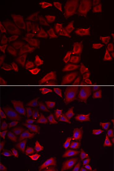 Immunofluorescence analysis of HeLa cells using SEPHS1 Polyclonal Antibody