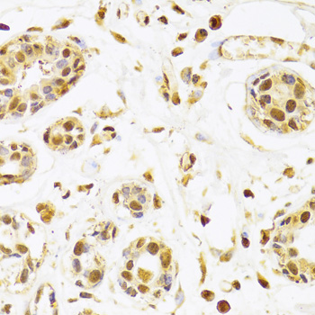 Immunohistochemistry of paraffin-embedded Human breast using SEPHS1 Polyclonal Antibody at dilution of  1:100 (40x lens).