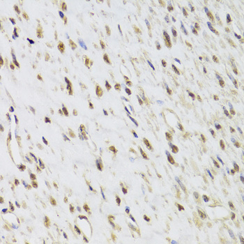 Immunohistochemistry of paraffin-embedded Human leiomyoma of uterus using SEPHS1 Polyclonal Antibody at dilution of  1:100 (40x lens).