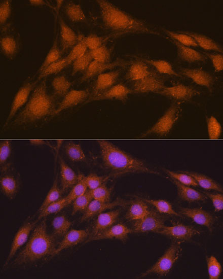 Immunofluorescence analysis of C6 cells using NRBF2 Polyclonal Antibody at dilution of  1:100. Blue: DAPI for nuclear staining.