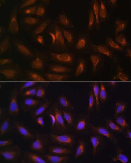 Immunofluorescence analysis of U-2 OS cells using NRBF2 Polyclonal Antibody at dilution of  1:100. Blue: DAPI for nuclear staining.