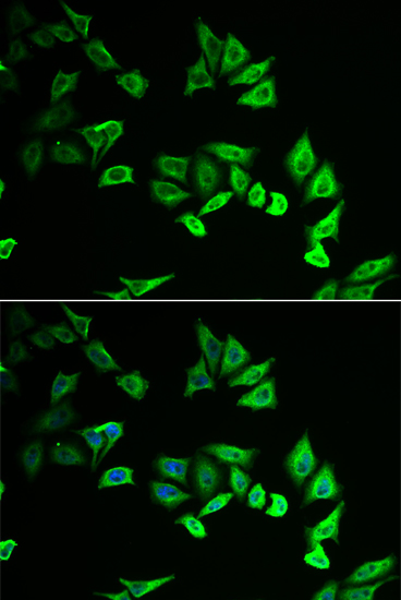 Immunofluorescence analysis of U2OS cells using MYOZ2 Polyclonal Antibody