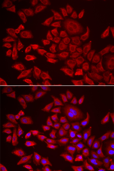 Immunofluorescence analysis of HeLa cells using AGPAT2 Polyclonal Antibody