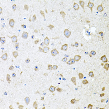 Immunohistochemistry of paraffin-embedded Mouse brain using AKAP5 Polyclonal Antibody at dilution of  1:100 (40x lens).