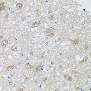 Immunohistochemistry of paraffin-embedded Rat brain using AKAP5 Polyclonal Antibody at dilution of  1:100 (40x lens).